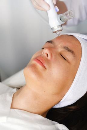 Carbon Laser Facial