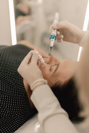 Radiofrequency Microneedling